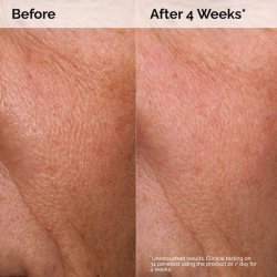 سرم آبرسان هیالورونیک اسید 2% + B5 اوردینری حجم 60 میلی لیتر